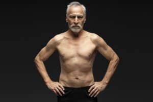 Senior Gynecomastia Surgery Denver